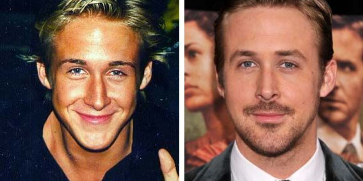 Ryan Gosling Plastic Surgery Did the ‘Grey Man’ Actor Get Work Done to His Face